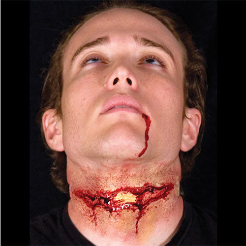 Bloody open trachea